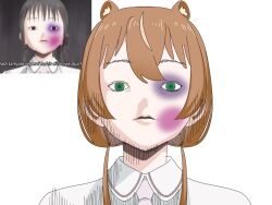 artist_request asobi_asobase ayunda_risu brown_hair bruise bruise_on_face green_eyes hololive hololive_indonesia injury meme virtual_youtuber white_background wounds