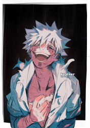 Rule 34 | 1boy, artist name, blue eyes, boku no hero academia, crazy smile, dabi (boku no hero academia), hand on own chest, kadeart, male focus, open mouth, scar, scar on arm, scar on chest, scar on face, short sleeves, smile, solo, stapled, stitched arm, stitched face, stitched torso, stitches, todoroki touya, torn clothes, white hair