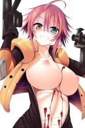 Rule 34 | 10s, 1girl, ahoge, bleeding, blood, breasts, bullet hole, center opening, deep wound, dual wielding, gloves, green eyes, grin, gun, heterochromia, holding, injury, jacket, large breasts, looking at viewer, monster girl, monster musume no iru nichijou, navel, nipples, no pupils, open clothes, open jacket, pink hair, puffy nipples, red hair, simple background, smile, solo, stitches, stomach, submachine gun, sukage, uniform, unzipped, upper body, weapon, white background, yellow eyes, zombie, zombina (monster musume)