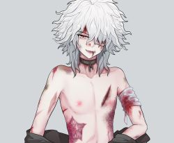 Rule 34 | 1boy, 7cs (congchuabuoito), bandage over one eye, bandaged arm, bandages, bare shoulders, blood, blood from mouth, broken, broken chain, chain, collar, collarbone, commentary request, danganronpa (series), danganronpa 2: goodbye despair, fangs, green jacket, grey background, highres, injury, jacket, komaeda nagito, male focus, medium hair, messy hair, metal collar, open mouth, revision, simple background, solo, undressing, white hair