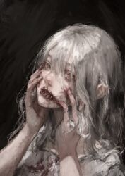 Rule 34 | 1girl, arai bokuseki, black background, bleeding, blood, blood on clothes, blood on face, blood on hands, commentary request, dress, expressionless, hands on own cheeks, hands on own face, highres, long hair, looking at viewer, original, pink eyes, sewn mouth, solo, white dress, white hair