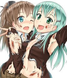 Rule 34 | 10s, 2girls, :d, aqua eyes, arm up, armpits, blood, breasts, brown hair, cleavage, deep wound, green eyes, green hair, hair ornament, hairclip, hand on another&#039;s shoulder, hawe king, injury, kantai collection, kumano (kancolle), long hair, looking at viewer, multiple girls, navel, one eye closed, open mouth, ponytail, scrape, smile, suzuya (kancolle), torn clothes, wavy mouth, white background