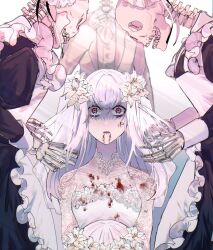 Rule 34 | 1girl, 3others, alternate costume, apron, blood, blood on clothes, blood on face, collarbone, commentary request, dress, fire emblem, fire emblem: three houses, flower, formal, hair flower, hair ornament, ice ice mint, long hair, lysithea von ordelia, maid, maid apron, multiple others, nintendo, open mouth, red eyes, skeleton, skull, suit, tears, white dress, white flower, white hair