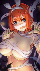 Rule 34 | 1girl, :d, bandaged arm, bandages, blue eyes, blurry, blurry foreground, blush, breasts, collarbone, depth of field, fang, go-toubun no hanayome, green nails, hair between eyes, halloween, hands up, highres, irarei (araisanblog), large breasts, looking at viewer, nail polish, nakano yotsuba, naked bandage, navel, open mouth, orange hair, smile, solo, twitter username, upper body