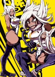 Rule 34 | 1girl, absurdres, animal ears, arms behind back, bare shoulders, blood, blue thighhighs, boku no hero academia, breasts, clenched teeth, closed mouth, covered navel, dark-skinned female, dark skin, forehead, grin, highleg, highleg leotard, highres, injury, kekel, large breasts, leaning back, legs apart, leotard, long hair, mirko, multiple views, open mouth, parted bangs, rabbit ears, rabbit girl, rabbit tail, red eyes, sharp teeth, sitting, smile, solo, spread legs, standing, tail, teeth, thighhighs, thighs, white hair, yellow background
