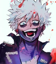 Rule 34 | 1boy, artist name, blood, blue eyes, boku no hero academia, burn scar, cheek piercing, dabi (boku no hero academia), highres, looking at viewer, male focus, messy hair, multiple scars, open mouth, piercing, scar, scar on neck, sharl0ck, solo, spoilers, staple, stapled, stitches, teeth, upper body, white background, white hair