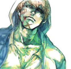 Rule 34 | 1boy, bandaid, bandaid on face, blood, blue eyes, blurry, brown eyes, bruise, bruise on face, bruised eye, closed mouth, collarbone, depth of field, heterochromia, hood, hood up, injury, looking at viewer, male focus, nosebleed, one piece, scar, scar on chin, scar on face, shiso i4, short hair, solo, white background, x drake