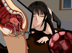 Rule 34 | 1girl, anus, black hair, bladder, cross-section, closed eyes, fallopian tubes, gamera 8th army, indoors, long hair, ovaries, pussy, speculum, tagme, tears, uterus, x-ray