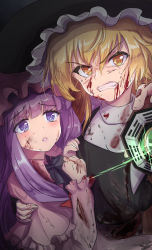 Rule 34 | 2girls, angry, blonde hair, blood, blood from mouth, blood on clothes, blood on face, blood on hands, blunt bangs, clenched teeth, hair ribbon, hat, highres, holding another&#039;s arm, kirisame marisa, long hair, long sleeves, looking at another, mini-hakkero, mob cap, multiple girls, namiki (remiter00), patchouli knowledge, purple eyes, purple hair, ribbon, teeth, touhou, witch hat, worried, yellow eyes