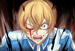 Rule 34 | angry, blood, blood on face, commission, head, highres, looking at viewer, open mouth, second-party source, short hair, solo, sword art online, sword art online: alicization, vankusman