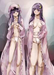 Rule 34 | 2girls, bad anatomy, bare shoulders, blunt bangs, breasts, crescent, crescent hair ornament, dual persona, flat chest, fundoshi, hair ornament, hair ribbon, hat, japanese clothes, large breasts, mob cap, multiple girls, no bra, no headwear, open clothes, open robe, patchouli knowledge, plump, purple eyes, purple hair, ribbon, ribs, robe, size difference, skinny, touhou, yohane