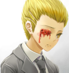Rule 34 | 1boy, black necktie, blonde hair, blood, blood on face, bloody tears, brown eyes, collared shirt, commentary request, danganronpa (series), danganronpa 2: goodbye despair, formal, frown, gradient background, grey background, grey jacket, hair slicked back, jacket, kuzuryu fuyuhiko, male focus, mole, mole under mouth, necktie, open clothes, open jacket, shirt, short hair, solo, stitches, upper body, white shirt, wing collar, youko-shima