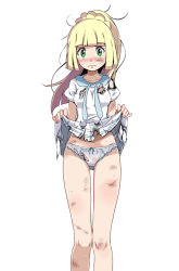 Rule 34 | 1girl, aqua bow, bare legs, blonde hair, blunt bangs, blush, bow, bruise, clothes lift, creatures (company), crying, crying with eyes open, cuts, dirty, dirty face, dress, game freak, green eyes, high ponytail, injury, lillie (pokemon), long hair, looking at viewer, nail polish, nintendo, panties, photoshop (medium), pleated dress, pleated skirt, pokemon, pokemon sm, shirt, short sleeves, sidelocks, simple background, skirt, skirt lift, solo, sweatdrop, tears, torn clothes, tsukishiro saika, underwear, white background, white panties, white shirt, white skirt