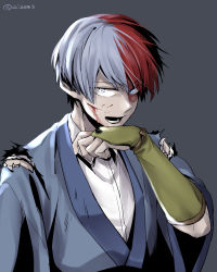 Rule 34 | 1boy, bad id, bad pixiv id, blood, blood on face, boku no hero academia, burn scar, clothing request, commentary request, fingerless gloves, gloves, grey background, grey eyes, hand up, heterochromia, injury, looking at viewer, male focus, multicolored hair, open mouth, red hair, scar, short hair, solo, todoroki shouto, tonomayo, torn clothes, twitter username, two-tone hair, upper body, white hair