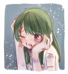 Rule 34 | 1girl, blood, blush, brown eyes, bruise, crying, female focus, green hair, hand on own face, hand on own head, highres, injury, karabako tanuki, long hair, one eye closed, open mouth, original, scar, simple background, solo, tears, trembling