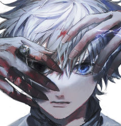 Rule 34 | 1boy, between fingers, black eyes, bleeding, blood, blood in hair, blood on face, blood on hands, blue eyes, closed mouth, commentary, electricity, expressionless, fingernails, hair between eyes, hands up, heterochromia, highres, holding, holding needle, hunter x hunter, killua zoldyck, looking at viewer, male focus, messy hair, needle, orokudesu, portrait, sharp fingernails, short hair, simple background, solo, white background, white hair
