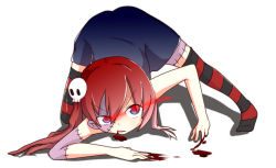 Rule 34 | 1girl, all fours, bent over, blood, blue eyes, blush, dress, female focus, full body, hair ornament, monster girl, multicolored eyes, original, ponytail, red eyes, scar, senkyoku niban, side ponytail, skull, solo, stitches, striped clothes, striped thighhighs, thighhighs, white background, zombie