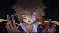 Rule 34 | 1boy, against glass, agi (kankarado), bandages, blonde hair, bruise, heterochromia, highres, injury, male focus, oliver (vocaloid), red eyes, short hair, solo, vocaloid, yellow eyes