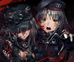 Rule 34 | 2girls, aamond, android, bandana, beret, bleeding, blood, blood on face, breasts, carrying, cleavage, closed eyes, commentary request, crying, crying with eyes open, g11 (girls&#039; frontline), girls&#039; frontline, goggles, goggles around neck, green eyes, guro, hat, highres, hk416 (girls&#039; frontline), injury, jacket, multiple girls, open mouth, silver hair, tears, torn clothes