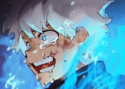Rule 34 | 1boy, aged down, blue eyes, blue fire, blurry, blurry background, blurry foreground, boku no hero academia, close-up, crying, crying with eyes open, cuts, depth of field, fire, gakuran, injury, jacket, male focus, mm39572, open mouth, school uniform, scratches, short hair, sobbing, solo, spiked hair, tears, todoroki touya, white hair