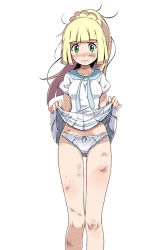 Rule 34 | 1girl, aqua bow, bare legs, blonde hair, blunt bangs, blush, bow, bruise, clothes lift, creatures (company), crying, crying with eyes open, cuts, dirty, dirty face, dress, game freak, green eyes, high ponytail, injury, lillie (pokemon), long hair, looking at viewer, nail polish, nintendo, panties, pleated dress, pleated skirt, pokemon, pokemon sm, shirt, short sleeves, sidelocks, simple background, skirt, skirt lift, solo, sweatdrop, tears, tsukishiro saika, underwear, white background, white panties, white shirt, white skirt