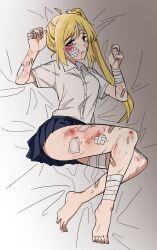 Rule 34 | 1girl, ahoge, bad anatomy, bandaged ankle, bandaged arm, bandaged head, bandaged leg, bandages, bandaid, bandaid on arm, bandaid on cheek, bandaid on face, bandaid on leg, barefoot, black skirt, blonde hair, blood, blood from mouth, bocchi the rock!, breasts, bruise, bruise on face, buttons, collared shirt, commentary request, dress shirt, dried blood, full body, furrowed brow, gauze on cheek, gauze on leg, grey shirt, half-closed eyes, hands up, highres, ijichi nijika, injury, jaggy lines, korean commentary, looking at viewer, lying, medium breasts, miniskirt, on back, on bed, orange eyes, parted lips, pleated skirt, raised eyebrows, reversed foot, ryona, scared, scratches, shirt, short sleeves, side ponytail, siribang1215, skirt, solo, wing collar