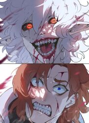 Rule 34 | 1boy, 1girl, aged down, black sclera, blood, blood on face, blood on teeth, blue eyes, clenched teeth, colored eyelashes, colored sclera, commentary, constricted pupils, cuts, derivative work, english commentary, hair between eyes, highres, horizontal pupils, horrified, horror (theme), injury, looking at viewer, mikhail (nyantcha), nyantcha, open mouth, orange eyes, orange hair, original, pale skin, pointy ears, saliva, scar, scar across eye, scar on face, sharp teeth, simple background, sister almonde (nyantcha), teeth, tongue, white background, white hair, wide-eyed