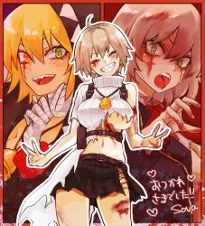 Rule 34 | 1girl, ahoge, bandaged hand, bandaged neck, bandages, bell, black hoodie, black jacket, black skirt, blazer, blonde hair, blood, blood on clothes, blood on face, blood on hands, blood on leg, blush, bow, bowtie, breasts, cafe no zombi-ko, cafe no zombi-ko (1st costume), cafe no zombi-ko (2nd costume), cafe no zombi-ko (3rd costume), closed mouth, collared shirt, commentary request, cowboy shot, green eyes, grin, harness, heterochromia, hood, hoodie, indie virtual youtuber, jacket, large breasts, long sleeves, looking at viewer, midriff, miniskirt, open clothes, open jacket, open mouth, project upd8, red bow, red bowtie, sharp teeth, shirt, short hair, skirt, sleeveless, sleeveless sweater, smile, sova2u, sweater, teeth, torn clothes, torn shirt, torn skirt, torn sweater, translation request, turtleneck, turtleneck sweater, underboob, upper body, virtual youtuber, white shirt, white sweater, zombie