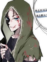 Rule 34 | blood, blood on face, blue eyes, green hoodie, highres, hood, hoodie, identity v, naib subedar, nanzhi759, open mouth, stitched mouth, stitches
