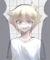 Rule 34 | 1boy, bandaid, bandaid on face, basil (faraway) (omori), basil (omori), blonde hair, blue eyes, bruise, bruised eye, highres, hospital gown, injury, looking at viewer, male focus, omo bc, omori, open mouth, short hair, short sleeves, sketch, solo, spoilers, sweat