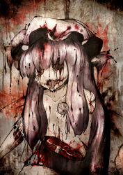 Rule 34 | 1girl, amputee, bad id, bad pixiv id, blood, deep wound, female focus, glasgow smile, guro, hat, hemicorporectomy, injury, koohee, long hair, no arms, no eyes, open mouth, patchouli knowledge, purple hair, saliva, scar, solo, stitches, tongue, touhou, very long hair