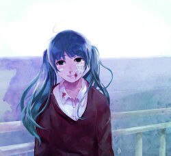 Rule 34 | 1girl, bandage on face, bandages, blood, blood on clothes, blood on face, blue eyes, blue hair, bruise, bruise on face, commentary, crying, english commentary, hatsune miku, injury, long hair, nosebleed, railing, rolling girl (vocaloid), shirt, smile, solo, sweater, twintails, twitchhhhh, vocaloid, white shirt