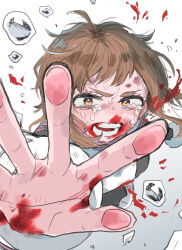 Rule 34 | 1girl, blood, blood on clothes, blood on face, blood on hands, blood splatter, boku no hero academia, brown eyes, brown hair, bruise, bruise on face, crying, highres, injury, looking at viewer, messy hair, pov, reaching, reaching towards viewer, short hair, simple background, solo, tears, ughama, uraraka ochako, white background