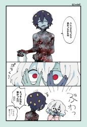 Rule 34 | 2girls, absurdres, bandages, burn scar, comic, covering own eyes, covering own mouth, flower, hair flower, hair ornament, highres, inahara, konno junko, mizuno ai, multiple girls, nude, pajamas, scar, stitches, surprised, tearing up, twitter username, wide-eyed, zombie land saga