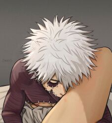 Rule 34 | 1boy, 1other, artist name, bed sheet, boku no hero academia, burn scar, closed eyes, dabi (boku no hero academia), einruji, grey background, highres, kiss, male focus, multiple scars, nipples, pov, scar, scar on chest, scar on face, short hair, simple background, spiked hair, spread legs, thighs, white hair