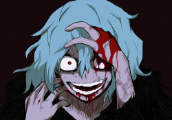 Rule 34 | 1boy, black background, blood, blood on face, blood on hands, blue hair, boku no hero academia, commentary request, hair between eyes, hand in own hair, highres, injury, looking at viewer, male focus, open mouth, portrait, red eyes, shigaraki tomura, shii (shiii24), short hair, simple background, smile, solo, teeth