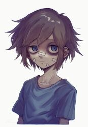 Rule 34 | 1boy, bandaid, bandaid on face, bandaid on nose, basil (faraway) (omori), basil (omori), blonde hair, blue eyes, bruise, bruised eye, closed mouth, collarbone, highres, hospital gown, hyaku (momongamomomo), injury, looking at viewer, omori, short hair, short sleeves, simple background, solo, spoilers, upper body, white background