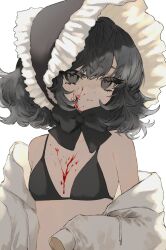 Rule 34 | 1girl, bikini, black bikini, black bow, black eyes, black hair, blood, blood on chest, blood on face, bow, breasts, chin strap, closed mouth, expressionless, fluffy hair, frilled bonnet, highres, hood, hoodie, looking at viewer, medium hair, off shoulder, open clothes, open hoodie, original, simple background, sleeves past fingers, sleeves past wrists, small breasts, solo, swimsuit, taezuodoru 0, thick eyelashes, upper body, white background, white hoodie