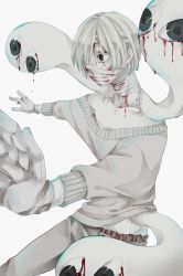 Rule 34 | akkirarara, bandages, blood, blood on face, bloody bandages, hair over one eye, marginal vivid worker, meme, monster boy, pale skin, personification, simple background, solo, stitches, white background, white hair, yume 2kki