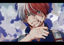 Rule 34 | 1boy, blood, blood on face, blue shirt, boku no hero academia, burn scar, cloud, commentary request, day, from below, grey hair, heterochromia, highres, letterboxed, looking at viewer, miyanami 3, multicolored hair, outdoors, red hair, scar, scar on face, shirt, short hair, solo, todoroki shouto, two-tone hair, upper body, white hair
