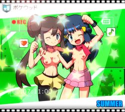 Rule 34 | 10s, 2girls, blue eyes, blue hair, breasts, brown hair, creatures (company), dawn (pokemon), flat chest, game freak, multiple girls, nintendo, nipples, pokemon, pokemon bw2, pokemon dppt, rorretsim, rosa (pokemon), topless, twintails