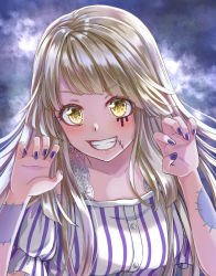 Rule 34 | 1girl, bang dream!, black nails, blow, blush, claw pose, collarbone, commentary request, dark background, grin, lace, long hair, nail polish, patchwork skin, rirachoko, shirt, smile, solo, stitches, striped clothes, striped shirt, tsurumaki kokoro, upper body, v-shaped eyebrows, vertical-striped clothes, vertical-striped shirt, yellow eyes, zombie