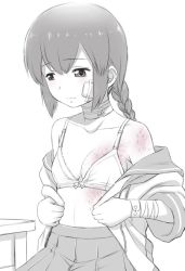 Rule 34 | 1girl, bandaged arm, bandages, bandaid, bandaid on cheek, bandaid on face, bra, braid, breasts, burn scar, closed mouth, ebifly, isonami (kancolle), kantai collection, long hair, looking away, looking down, open clothes, open shirt, pleated skirt, scar, school uniform, serafuku, short sleeves, sitting, skirt, small breasts, solo, spot color, underwear, undressing
