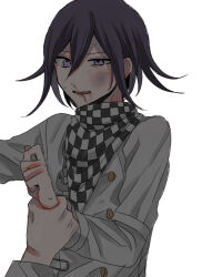 Rule 34 | 1boy, black hair, blood, blush, bruise, bruise on face, buttons, checkered clothes, checkered scarf, danganronpa (series), danganronpa v3: killing harmony, flipped hair, grey jacket, highres, holding another&#039;s wrist, injury, jacket, kasou (roomno404 ), long sleeves, male focus, medium hair, nosebleed, oma kokichi, open mouth, pink eyes, scarf, solo focus, sweat, upper body, white background