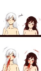 Rule 34 | 2girls, alternate hair length, alternate hairstyle, arrow (symbol), blood, blush, brown hair, completely nude, kuma (bloodycolor), looking at another, looking to the side, multiple girls, nosebleed, nude, one eye closed, ruby rose, rwby, scar, scar across eye, scar on face, simple background, weiss schnee, white hair