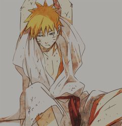 Rule 34 | 1boy, arms up, blonde hair, blue eyes, chappa (chappa7610), facial mark, gradient background, injury, male focus, naruto, naruto (series), scar, scratches, sitting, solo, uzumaki naruto