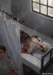 Rule 34 | 2boys, absurdres, amputee, armband, blonde hair, blood, blood on face, collared shirt, from above, highres, indoors, luguoadeli (maple12031), lying, male focus, marley military uniform, multiple boys, on back, on bed, porco galliard, reiner braun, scene reference, shingeki no kyojin, shirt, short hair, soldier, sunlight