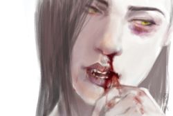 Rule 34 | 1girl, apple (appleuniversing), blood, blood on face, blood on hands, brown hair, bruise, bruise on face, bruised eye, fang, green eyes, hand on own face, hand up, injury, lips, long hair, looking to the side, nose, nosebleed, open mouth, overwatch, overwatch 1, parted lips, portrait, simple background, solo, teeth, white background, widowmaker (overwatch)